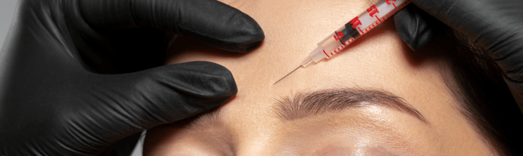 microneedling near me atlanta ga (5)